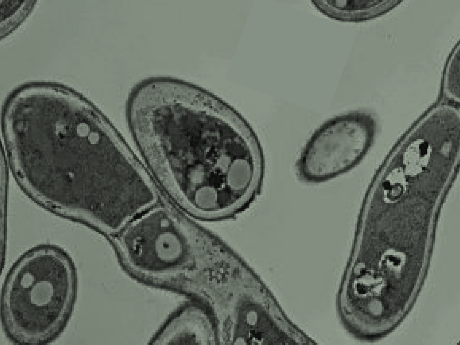 The Transsulphuration Pathway: Your body's antioxidant engine