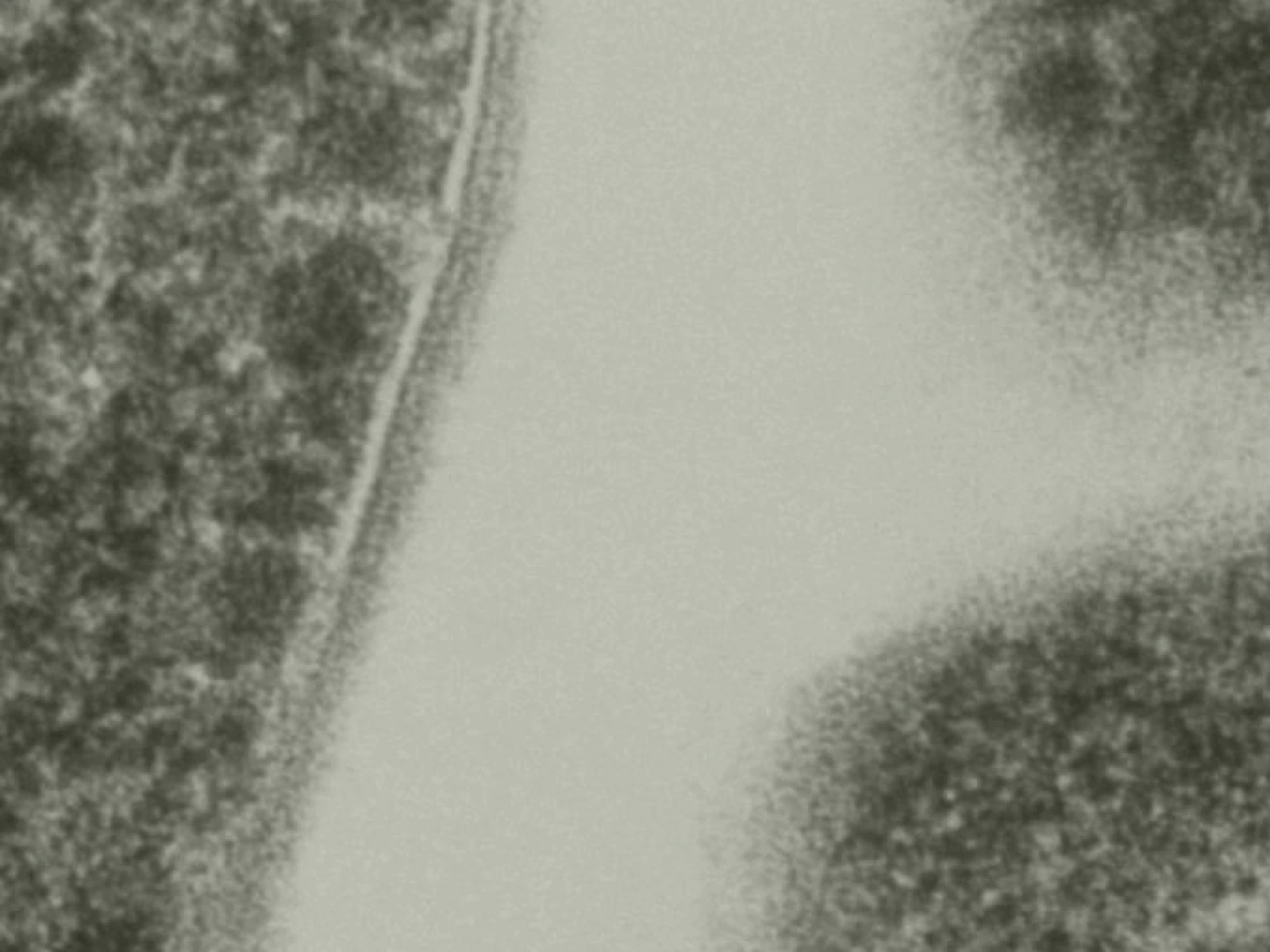 The Urea Cycle: Your body's detox pathway for ammonia
